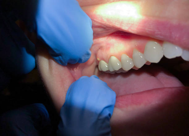 Best Pediatric Emergency Dentist in Wynne, AR